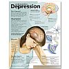 Understanding Depression Anatomical  - att frst depression affisch 50x65cm laminerad